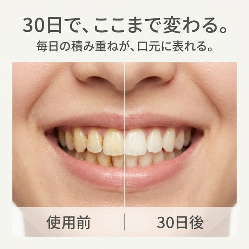 アルケア U字電動歯ブラシ