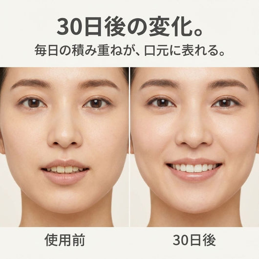 アルケア U字電動歯ブラシ