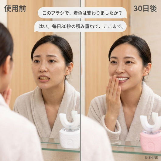 アルケア U字電動歯ブラシ